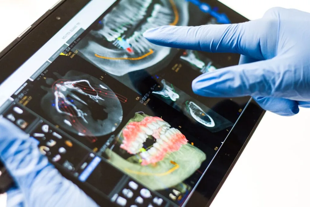 clinica stomatologică, implant dentar, dinți ficși, chirurgie oro-maxilo-facială, tratament stomatologic, proteză dentară, consultație stomatologică, medic dentist, estetică dentară, sănătate orală, dantură fixă, recenzii pacienți, servicii dentare, dantură completă, implant digital, parteneri implanturi, ghid chirurgical, echipă stomatologică, prețuri implanturi, prevenție dentară, clinica stomatologică București, implant dentar București, dinți ficși București, chirurgie oro-maxilo-facială București, tratament stomatologic București, proteză dentară București, consultație stomatologică București, medic dentist București, estetică dentară București, sănătate orală București, dantură fixă București, recenzii pacienți București, servicii dentare București, dantură completă București, implant digital București, parteneri implanturi București, ghid chirurgical București, echipă stomatologică București, prețuri implanturi București, prevenție dentară București