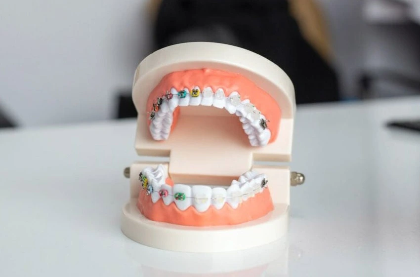 clinica stomatologică, implant dentar, dinți ficși, chirurgie oro-maxilo-facială, tratament stomatologic, proteză dentară, consultație stomatologică, medic dentist, estetică dentară, sănătate orală, dantură fixă, recenzii pacienți, servicii dentare, dantură completă, implant digital, parteneri implanturi, ghid chirurgical, echipă stomatologică, prețuri implanturi, prevenție dentară, clinica stomatologică București, implant dentar București, dinți ficși București, chirurgie oro-maxilo-facială București, tratament stomatologic București, proteză dentară București, consultație stomatologică București, medic dentist București, estetică dentară București, sănătate orală București, dantură fixă București, recenzii pacienți București, servicii dentare București, dantură completă București, implant digital București, parteneri implanturi București, ghid chirurgical București, echipă stomatologică București, prețuri implanturi București, prevenție dentară București
