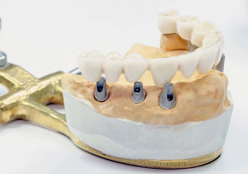 clinica stomatologică, implant dentar, dinți ficși, chirurgie oro-maxilo-facială, tratament stomatologic, proteză dentară, consultație stomatologică, medic dentist, estetică dentară, sănătate orală, dantură fixă, recenzii pacienți, servicii dentare, dantură completă, implant digital, parteneri implanturi, ghid chirurgical, echipă stomatologică, prețuri implanturi, prevenție dentară, clinica stomatologică București, implant dentar București, dinți ficși București, chirurgie oro-maxilo-facială București, tratament stomatologic București, proteză dentară București, consultație stomatologică București, medic dentist București, estetică dentară București, sănătate orală București, dantură fixă București, recenzii pacienți București, servicii dentare București, dantură completă București, implant digital București, parteneri implanturi București, ghid chirurgical București, echipă stomatologică București, prețuri implanturi București, prevenție dentară București