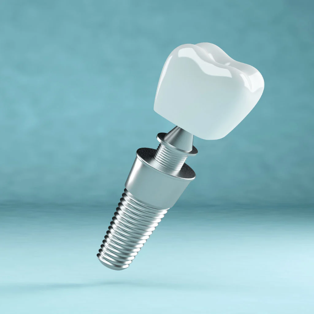 clinica stomatologică, implant dentar, dinți ficși, chirurgie oro-maxilo-facială, tratament stomatologic, proteză dentară, consultație stomatologică, medic dentist, estetică dentară, sănătate orală, dantură fixă, recenzii pacienți, servicii dentare, dantură completă, implant digital, parteneri implanturi, ghid chirurgical, echipă stomatologică, prețuri implanturi, prevenție dentară, clinica stomatologică București, implant dentar București, dinți ficși București, chirurgie oro-maxilo-facială București, tratament stomatologic București, proteză dentară București, consultație stomatologică București, medic dentist București, estetică dentară București, sănătate orală București, dantură fixă București, recenzii pacienți București, servicii dentare București, dantură completă București, implant digital București, parteneri implanturi București, ghid chirurgical București, echipă stomatologică București, prețuri implanturi București, prevenție dentară București