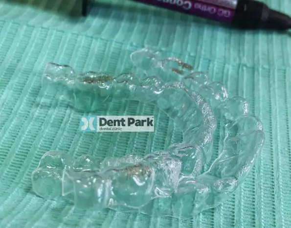 clinica stomatologică, implant dentar, dinți ficși, chirurgie oro-maxilo-facială, tratament stomatologic, proteză dentară, consultație stomatologică, medic dentist, estetică dentară, sănătate orală, dantură fixă, recenzii pacienți, servicii dentare, dantură completă, implant digital, parteneri implanturi, ghid chirurgical, echipă stomatologică, prețuri implanturi, prevenție dentară, clinica stomatologică București, implant dentar București, dinți ficși București, chirurgie oro-maxilo-facială București, tratament stomatologic București, proteză dentară București, consultație stomatologică București, medic dentist București, estetică dentară București, sănătate orală București, dantură fixă București, recenzii pacienți București, servicii dentare București, dantură completă București, implant digital București, parteneri implanturi București, ghid chirurgical București, echipă stomatologică București, prețuri implanturi București, prevenție dentară București