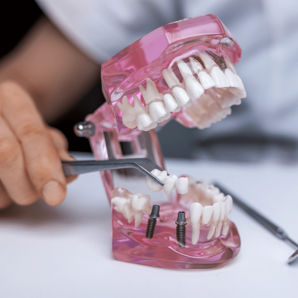 clinica stomatologică, implant dentar, dinți ficși, chirurgie oro-maxilo-facială, tratament stomatologic, proteză dentară, consultație stomatologică, medic dentist, estetică dentară, sănătate orală, dantură fixă, recenzii pacienți, servicii dentare, dantură completă, implant digital, parteneri implanturi, ghid chirurgical, echipă stomatologică, prețuri implanturi, prevenție dentară, clinica stomatologică București, implant dentar București, dinți ficși București, chirurgie oro-maxilo-facială București, tratament stomatologic București, proteză dentară București, consultație stomatologică București, medic dentist București, estetică dentară București, sănătate orală București, dantură fixă București, recenzii pacienți București, servicii dentare București, dantură completă București, implant digital București, parteneri implanturi București, ghid chirurgical București, echipă stomatologică București, prețuri implanturi București, prevenție dentară București