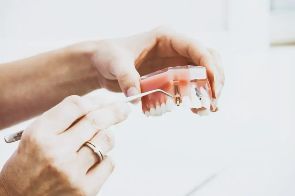 clinica stomatologică, implant dentar, dinți ficși, chirurgie oro-maxilo-facială, tratament stomatologic, proteză dentară, consultație stomatologică, medic dentist, estetică dentară, sănătate orală, dantură fixă, recenzii pacienți, servicii dentare, dantură completă, implant digital, parteneri implanturi, ghid chirurgical, echipă stomatologică, prețuri implanturi, prevenție dentară, clinica stomatologică București, implant dentar București, dinți ficși București, chirurgie oro-maxilo-facială București, tratament stomatologic București, proteză dentară București, consultație stomatologică București, medic dentist București, estetică dentară București, sănătate orală București, dantură fixă București, recenzii pacienți București, servicii dentare București, dantură completă București, implant digital București, parteneri implanturi București, ghid chirurgical București, echipă stomatologică București, prețuri implanturi București, prevenție dentară București