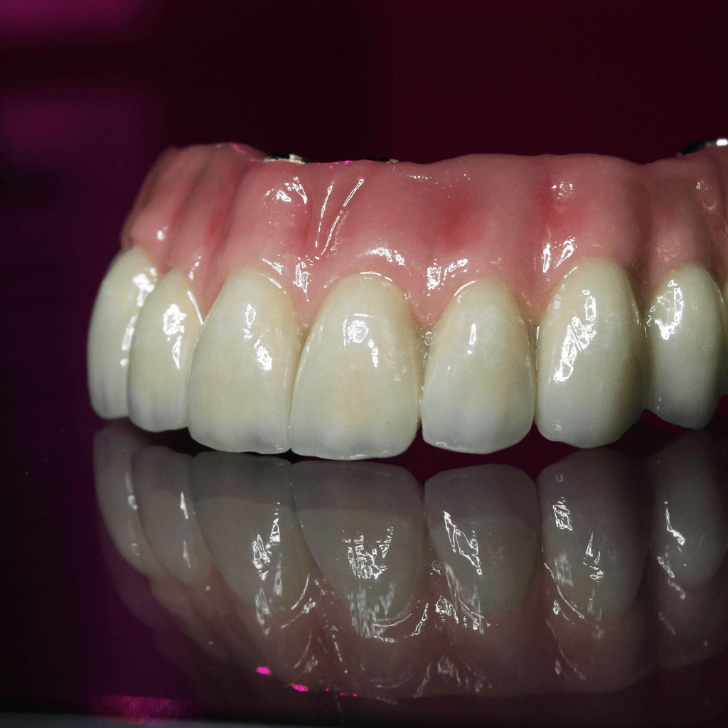 clinica stomatologică, implant dentar, dinți ficși, chirurgie oro-maxilo-facială, tratament stomatologic, proteză dentară, consultație stomatologică, medic dentist, estetică dentară, sănătate orală, dantură fixă, recenzii pacienți, servicii dentare, dantură completă, implant digital, parteneri implanturi, ghid chirurgical, echipă stomatologică, prețuri implanturi, prevenție dentară, clinica stomatologică București, implant dentar București, dinți ficși București, chirurgie oro-maxilo-facială București, tratament stomatologic București, proteză dentară București, consultație stomatologică București, medic dentist București, estetică dentară București, sănătate orală București, dantură fixă București, recenzii pacienți București, servicii dentare București, dantură completă București, implant digital București, parteneri implanturi București, ghid chirurgical București, echipă stomatologică București, prețuri implanturi București, prevenție dentară București