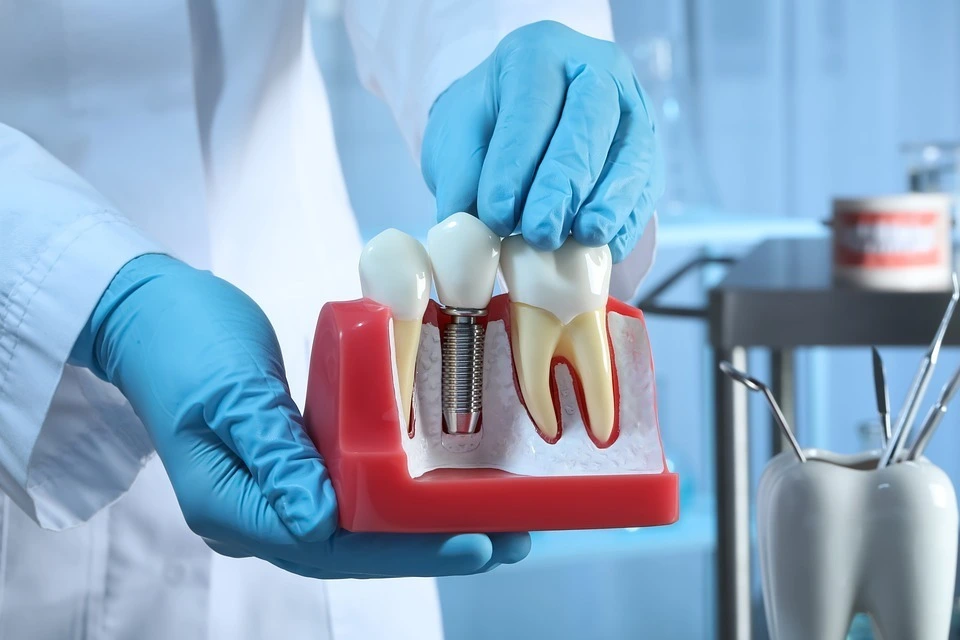 clinica stomatologică, implant dentar, dinți ficși, chirurgie oro-maxilo-facială, tratament stomatologic, proteză dentară, consultație stomatologică, medic dentist, estetică dentară, sănătate orală, dantură fixă, recenzii pacienți, servicii dentare, dantură completă, implant digital, parteneri implanturi, ghid chirurgical, echipă stomatologică, prețuri implanturi, prevenție dentară, clinica stomatologică București, implant dentar București, dinți ficși București, chirurgie oro-maxilo-facială București, tratament stomatologic București, proteză dentară București, consultație stomatologică București, medic dentist București, estetică dentară București, sănătate orală București, dantură fixă București, recenzii pacienți București, servicii dentare București, dantură completă București, implant digital București, parteneri implanturi București, ghid chirurgical București, echipă stomatologică București, prețuri implanturi București, prevenție dentară București