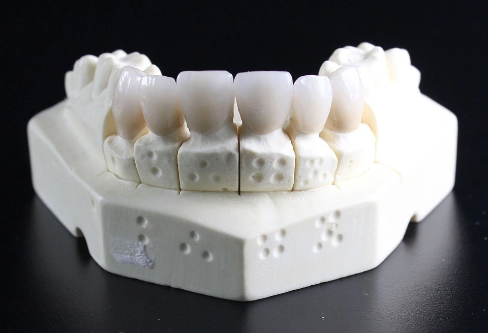 clinica stomatologică, implant dentar, dinți ficși, chirurgie oro-maxilo-facială, tratament stomatologic, proteză dentară, consultație stomatologică, medic dentist, estetică dentară, sănătate orală, dantură fixă, recenzii pacienți, servicii dentare, dantură completă, implant digital, parteneri implanturi, ghid chirurgical, echipă stomatologică, prețuri implanturi, prevenție dentară, clinica stomatologică București, implant dentar București, dinți ficși București, chirurgie oro-maxilo-facială București, tratament stomatologic București, proteză dentară București, consultație stomatologică București, medic dentist București, estetică dentară București, sănătate orală București, dantură fixă București, recenzii pacienți București, servicii dentare București, dantură completă București, implant digital București, parteneri implanturi București, ghid chirurgical București, echipă stomatologică București, prețuri implanturi București, prevenție dentară București