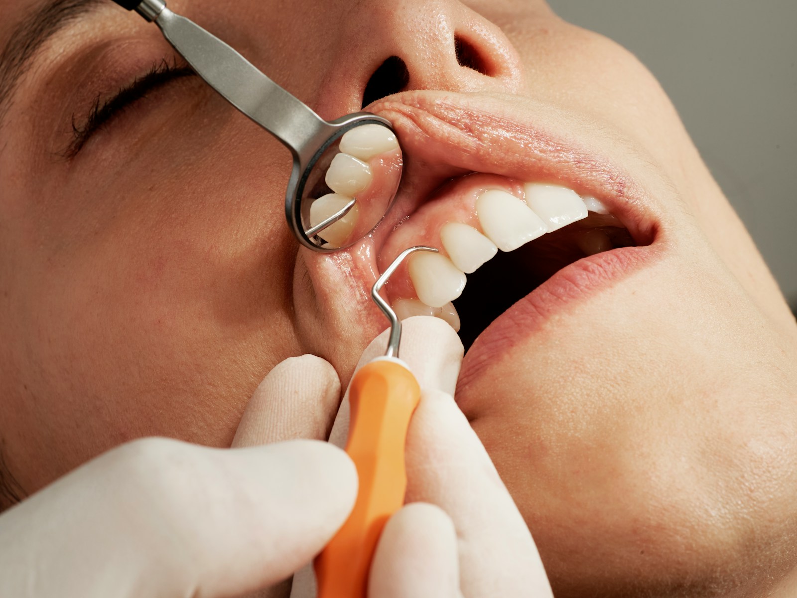 Consultație implant dentar