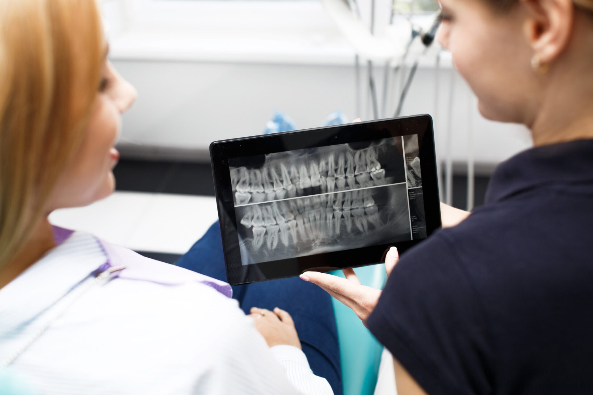 Durata Viata Implant Dentar