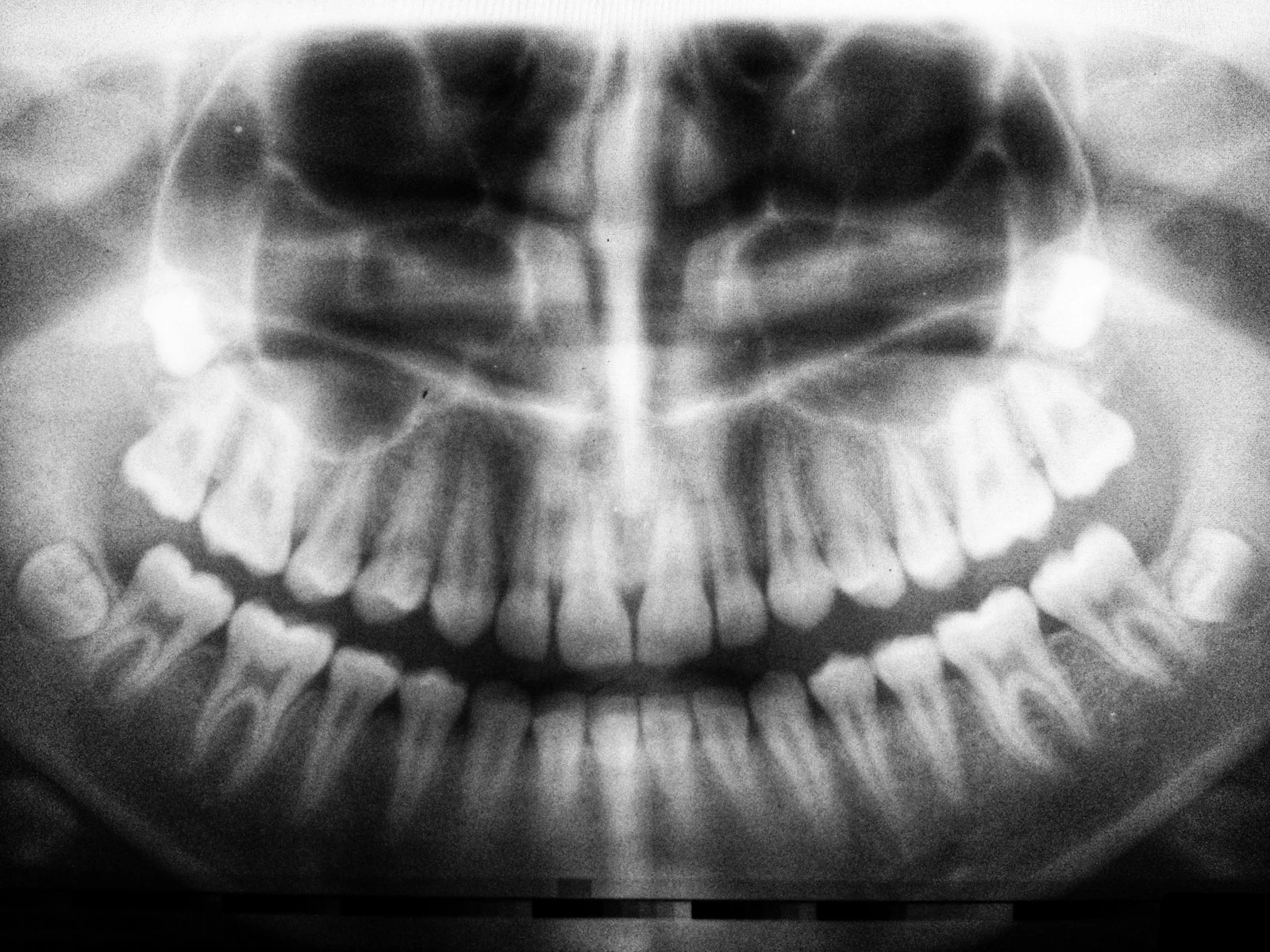clinica stomatologică, implant dentar, dinți ficși, chirurgie oro-maxilo-facială, tratament stomatologic, proteză dentară, consultație stomatologică, medic dentist, estetică dentară, sănătate orală, dantură fixă, recenzii pacienți, servicii dentare, dantură completă, implant digital, parteneri implanturi, ghid chirurgical, echipă stomatologică, prețuri implanturi, prevenție dentară, clinica stomatologică București, implant dentar București, dinți ficși București, chirurgie oro-maxilo-facială București, tratament stomatologic București, proteză dentară București, consultație stomatologică București, medic dentist București, estetică dentară București, sănătate orală București, dantură fixă București, recenzii pacienți București, servicii dentare București, dantură completă București, implant digital București, parteneri implanturi București, ghid chirurgical București, echipă stomatologică București, prețuri implanturi București, prevenție dentară București