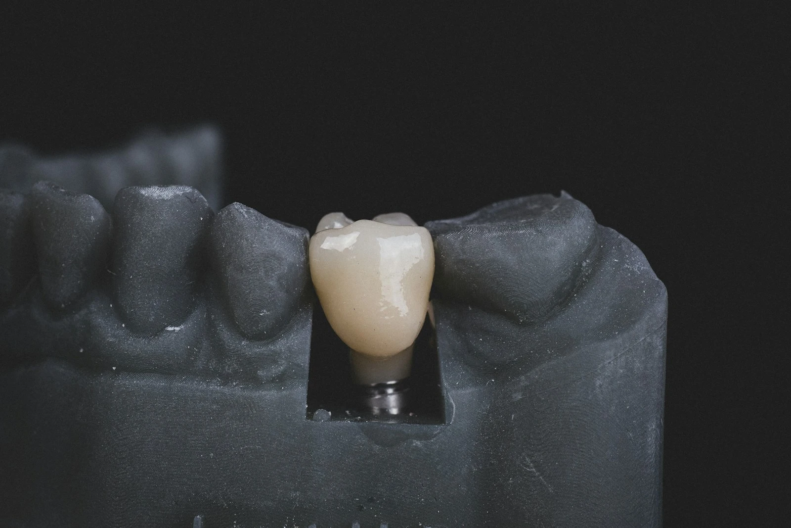 clinica stomatologică, implant dentar, dinți ficși, chirurgie oro-maxilo-facială, tratament stomatologic, proteză dentară, consultație stomatologică, medic dentist, estetică dentară, sănătate orală, dantură fixă, recenzii pacienți, servicii dentare, dantură completă, implant digital, parteneri implanturi, ghid chirurgical, echipă stomatologică, prețuri implanturi, prevenție dentară, clinica stomatologică București, implant dentar București, dinți ficși București, chirurgie oro-maxilo-facială București, tratament stomatologic București, proteză dentară București, consultație stomatologică București, medic dentist București, estetică dentară București, sănătate orală București, dantură fixă București, recenzii pacienți București, servicii dentare București, dantură completă București, implant digital București, parteneri implanturi București, ghid chirurgical București, echipă stomatologică București, prețuri implanturi București, prevenție dentară București