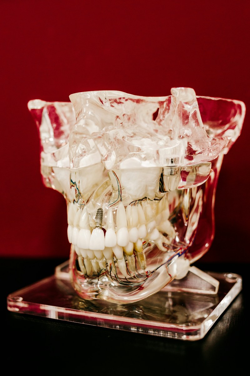 Tehnologie implant dentar