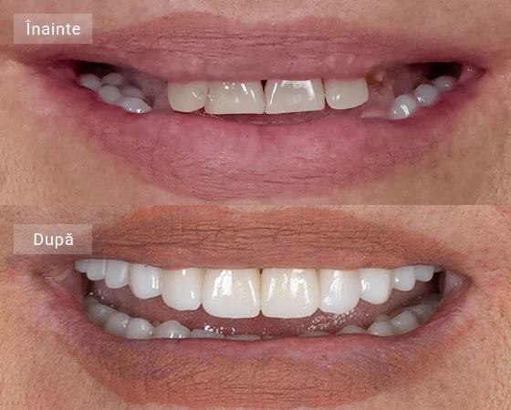 before after eugenia
