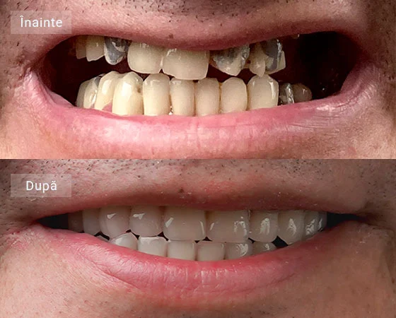 before after marian