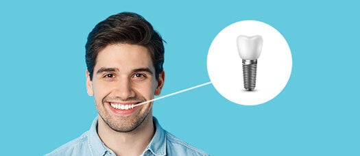 Estetica si Protetica 2 Implanturi dentare