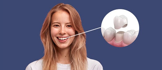 Estetica si Protetica 1 coroane dentare