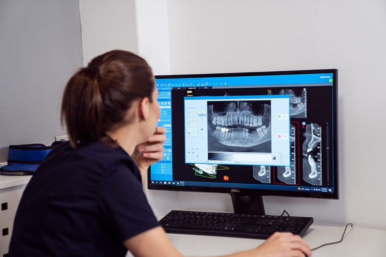 Ce nu stiai despre Implantul Dentar 1 1