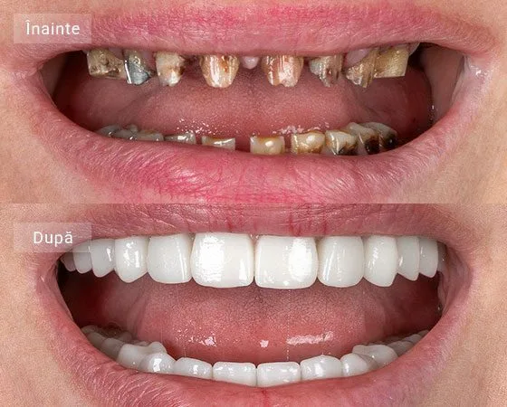 before after Sava Elena