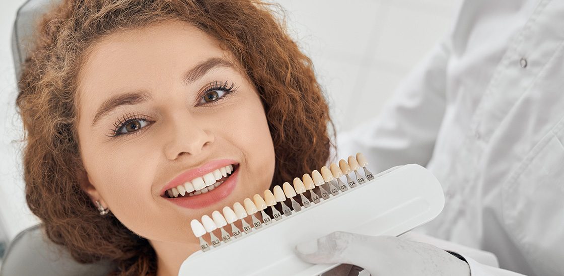 Fatete Dentare Bucuresti