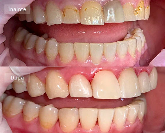 Margarita before after