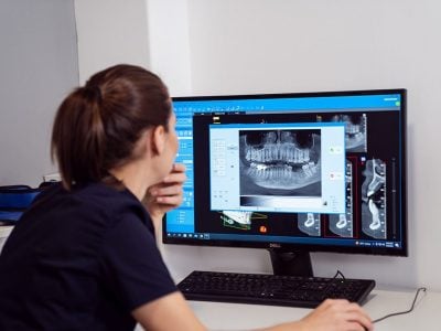 Ce-nu-știai-despre-Implantul-Dentar-1