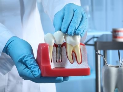 clinica stomatologică, implant dentar, dinți ficși, chirurgie oro-maxilo-facială, tratament stomatologic, proteză dentară, consultație stomatologică, medic dentist, estetică dentară, sănătate orală, dantură fixă, recenzii pacienți, servicii dentare, dantură completă, implant digital, parteneri implanturi, ghid chirurgical, echipă stomatologică, prețuri implanturi, prevenție dentară, clinica stomatologică București, implant dentar București, dinți ficși București, chirurgie oro-maxilo-facială București, tratament stomatologic București, proteză dentară București, consultație stomatologică București, medic dentist București, estetică dentară București, sănătate orală București, dantură fixă București, recenzii pacienți București, servicii dentare București, dantură completă București, implant digital București, parteneri implanturi București, ghid chirurgical București, echipă stomatologică București, prețuri implanturi București, prevenție dentară București