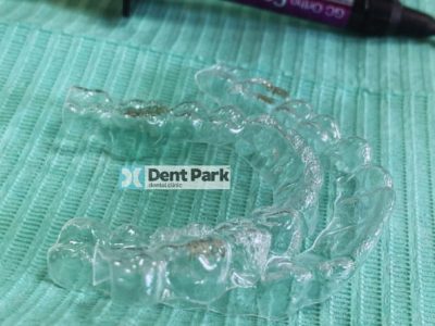 clinica stomatologică, implant dentar, dinți ficși, chirurgie oro-maxilo-facială, tratament stomatologic, proteză dentară, consultație stomatologică, medic dentist, estetică dentară, sănătate orală, dantură fixă, recenzii pacienți, servicii dentare, dantură completă, implant digital, parteneri implanturi, ghid chirurgical, echipă stomatologică, prețuri implanturi, prevenție dentară, clinica stomatologică București, implant dentar București, dinți ficși București, chirurgie oro-maxilo-facială București, tratament stomatologic București, proteză dentară București, consultație stomatologică București, medic dentist București, estetică dentară București, sănătate orală București, dantură fixă București, recenzii pacienți București, servicii dentare București, dantură completă București, implant digital București, parteneri implanturi București, ghid chirurgical București, echipă stomatologică București, prețuri implanturi București, prevenție dentară București