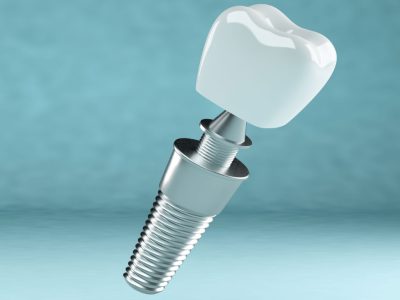 clinica stomatologică, implant dentar, dinți ficși, chirurgie oro-maxilo-facială, tratament stomatologic, proteză dentară, consultație stomatologică, medic dentist, estetică dentară, sănătate orală, dantură fixă, recenzii pacienți, servicii dentare, dantură completă, implant digital, parteneri implanturi, ghid chirurgical, echipă stomatologică, prețuri implanturi, prevenție dentară, clinica stomatologică București, implant dentar București, dinți ficși București, chirurgie oro-maxilo-facială București, tratament stomatologic București, proteză dentară București, consultație stomatologică București, medic dentist București, estetică dentară București, sănătate orală București, dantură fixă București, recenzii pacienți București, servicii dentare București, dantură completă București, implant digital București, parteneri implanturi București, ghid chirurgical București, echipă stomatologică București, prețuri implanturi București, prevenție dentară București