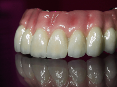 clinica stomatologică, implant dentar, dinți ficși, chirurgie oro-maxilo-facială, tratament stomatologic, proteză dentară, consultație stomatologică, medic dentist, estetică dentară, sănătate orală, dantură fixă, recenzii pacienți, servicii dentare, dantură completă, implant digital, parteneri implanturi, ghid chirurgical, echipă stomatologică, prețuri implanturi, prevenție dentară, clinica stomatologică București, implant dentar București, dinți ficși București, chirurgie oro-maxilo-facială București, tratament stomatologic București, proteză dentară București, consultație stomatologică București, medic dentist București, estetică dentară București, sănătate orală București, dantură fixă București, recenzii pacienți București, servicii dentare București, dantură completă București, implant digital București, parteneri implanturi București, ghid chirurgical București, echipă stomatologică București, prețuri implanturi București, prevenție dentară București