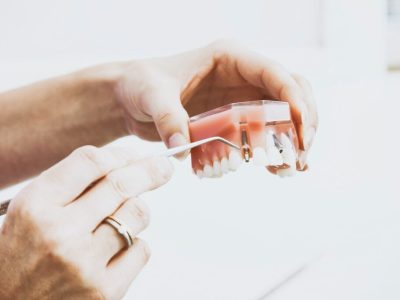 clinica stomatologică, implant dentar, dinți ficși, chirurgie oro-maxilo-facială, tratament stomatologic, proteză dentară, consultație stomatologică, medic dentist, estetică dentară, sănătate orală, dantură fixă, recenzii pacienți, servicii dentare, dantură completă, implant digital, parteneri implanturi, ghid chirurgical, echipă stomatologică, prețuri implanturi, prevenție dentară, clinica stomatologică București, implant dentar București, dinți ficși București, chirurgie oro-maxilo-facială București, tratament stomatologic București, proteză dentară București, consultație stomatologică București, medic dentist București, estetică dentară București, sănătate orală București, dantură fixă București, recenzii pacienți București, servicii dentare București, dantură completă București, implant digital București, parteneri implanturi București, ghid chirurgical București, echipă stomatologică București, prețuri implanturi București, prevenție dentară București