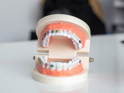 clinica stomatologică, implant dentar, dinți ficși, chirurgie oro-maxilo-facială, tratament stomatologic, proteză dentară, consultație stomatologică, medic dentist, estetică dentară, sănătate orală, dantură fixă, recenzii pacienți, servicii dentare, dantură completă, implant digital, parteneri implanturi, ghid chirurgical, echipă stomatologică, prețuri implanturi, prevenție dentară, clinica stomatologică București, implant dentar București, dinți ficși București, chirurgie oro-maxilo-facială București, tratament stomatologic București, proteză dentară București, consultație stomatologică București, medic dentist București, estetică dentară București, sănătate orală București, dantură fixă București, recenzii pacienți București, servicii dentare București, dantură completă București, implant digital București, parteneri implanturi București, ghid chirurgical București, echipă stomatologică București, prețuri implanturi București, prevenție dentară București