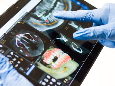 clinica stomatologică, implant dentar, dinți ficși, chirurgie oro-maxilo-facială, tratament stomatologic, proteză dentară, consultație stomatologică, medic dentist, estetică dentară, sănătate orală, dantură fixă, recenzii pacienți, servicii dentare, dantură completă, implant digital, parteneri implanturi, ghid chirurgical, echipă stomatologică, prețuri implanturi, prevenție dentară, clinica stomatologică București, implant dentar București, dinți ficși București, chirurgie oro-maxilo-facială București, tratament stomatologic București, proteză dentară București, consultație stomatologică București, medic dentist București, estetică dentară București, sănătate orală București, dantură fixă București, recenzii pacienți București, servicii dentare București, dantură completă București, implant digital București, parteneri implanturi București, ghid chirurgical București, echipă stomatologică București, prețuri implanturi București, prevenție dentară București